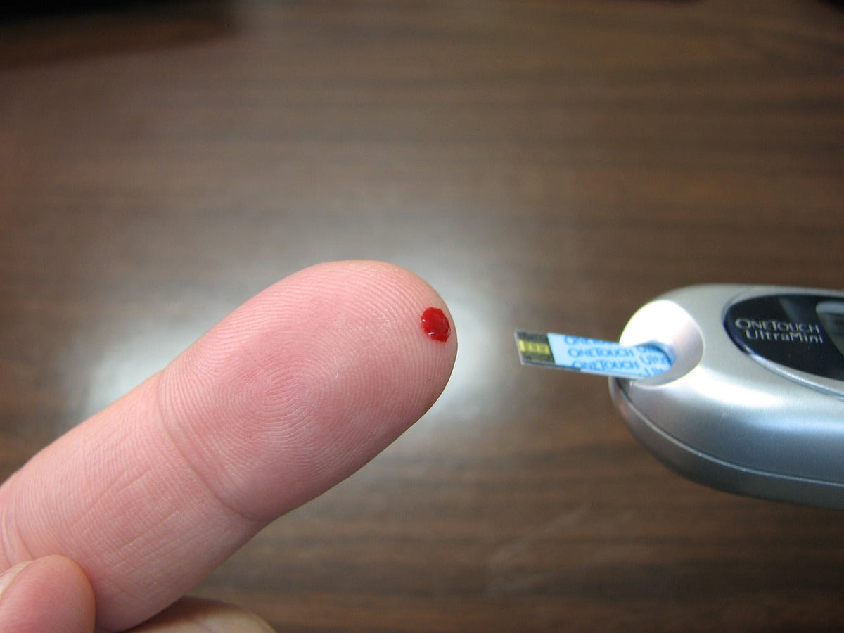 Prueba de glucosa en sangre